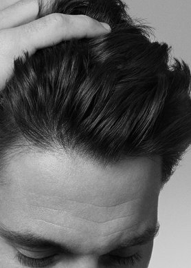 everything-you-need-to-know-about-adherent-dandruff