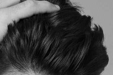 everything-you-need-to-know-about-adherent-dandruff