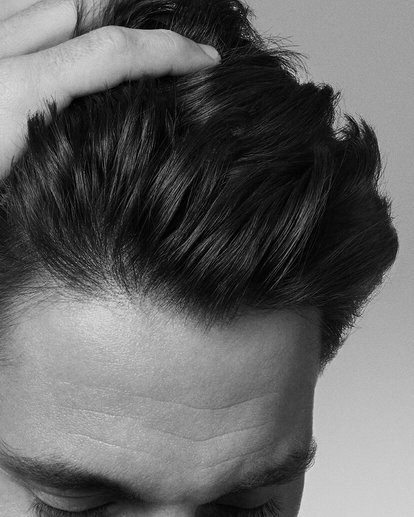 everything-you-need-to-know-about-adherent-dandruff