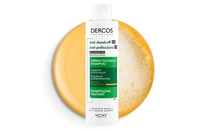 does dandruff cause hair loss