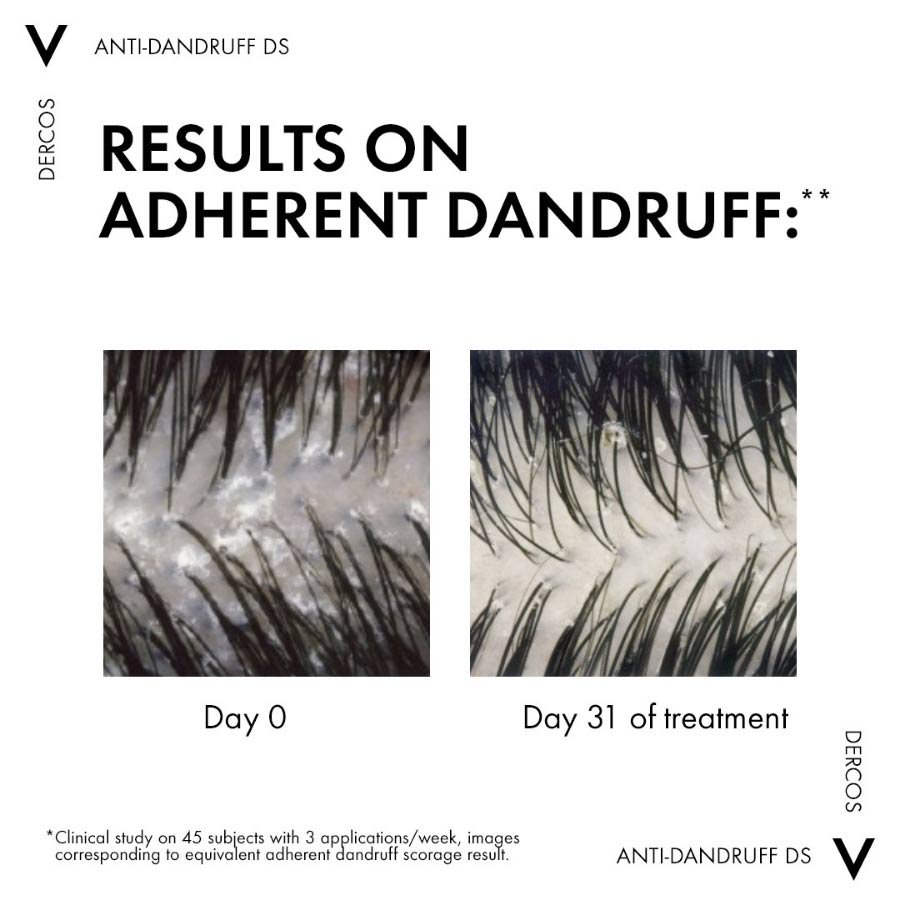 anti-dandruff-shampoo-sensitive-scalp-pack3